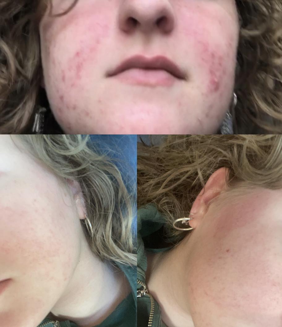 Photo from review by zoe !