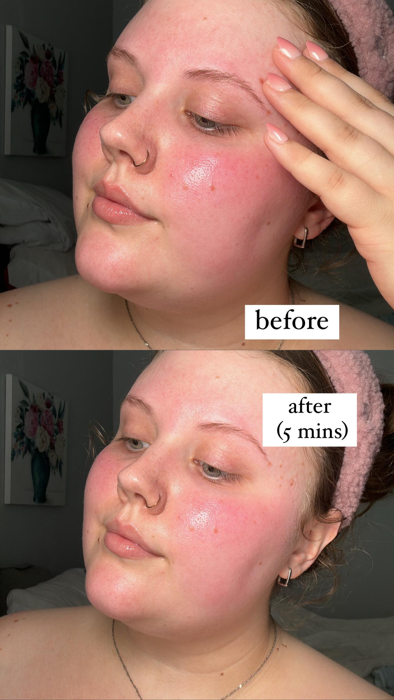 Photo from review by Customer