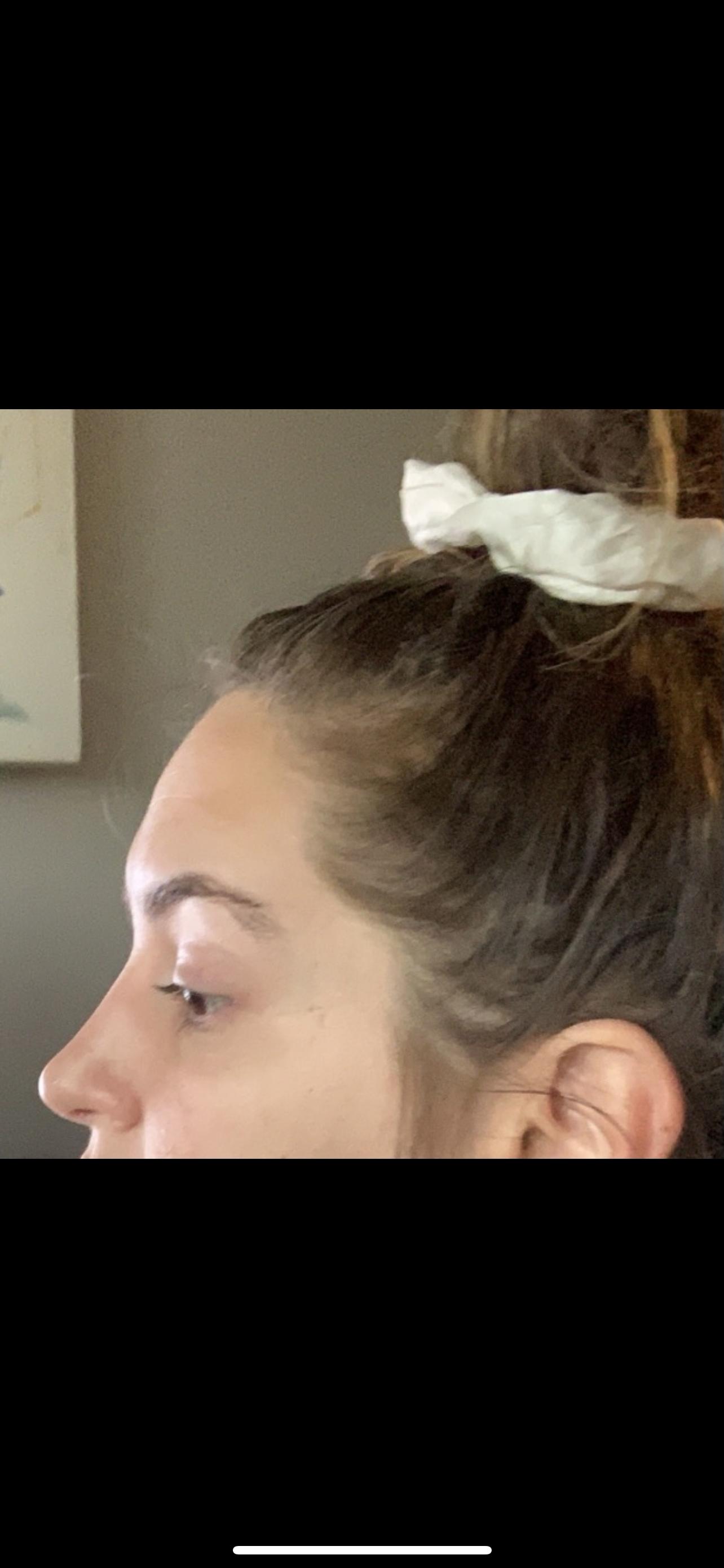 Photo from review by Tessaona
