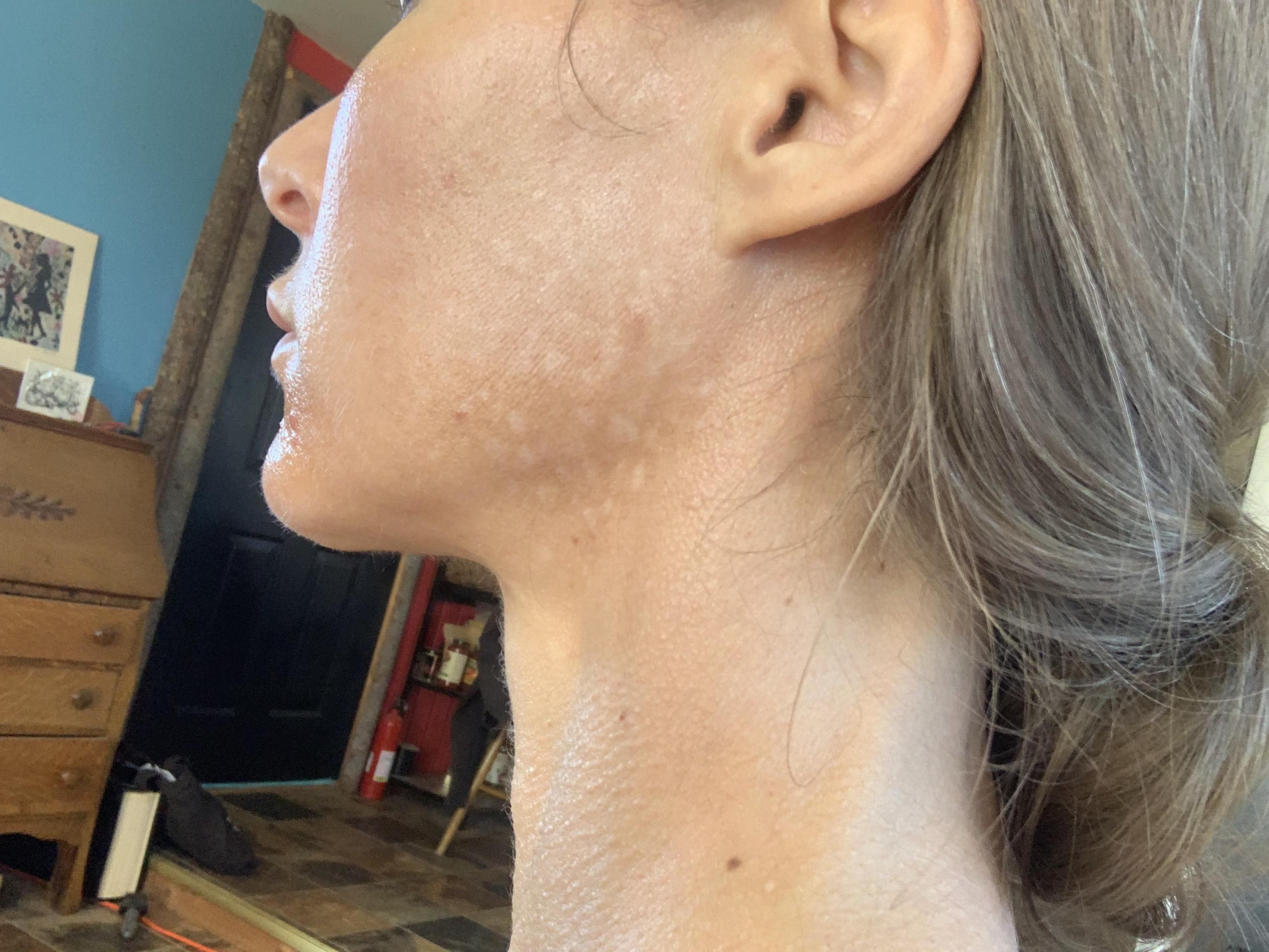 Photo from review by B