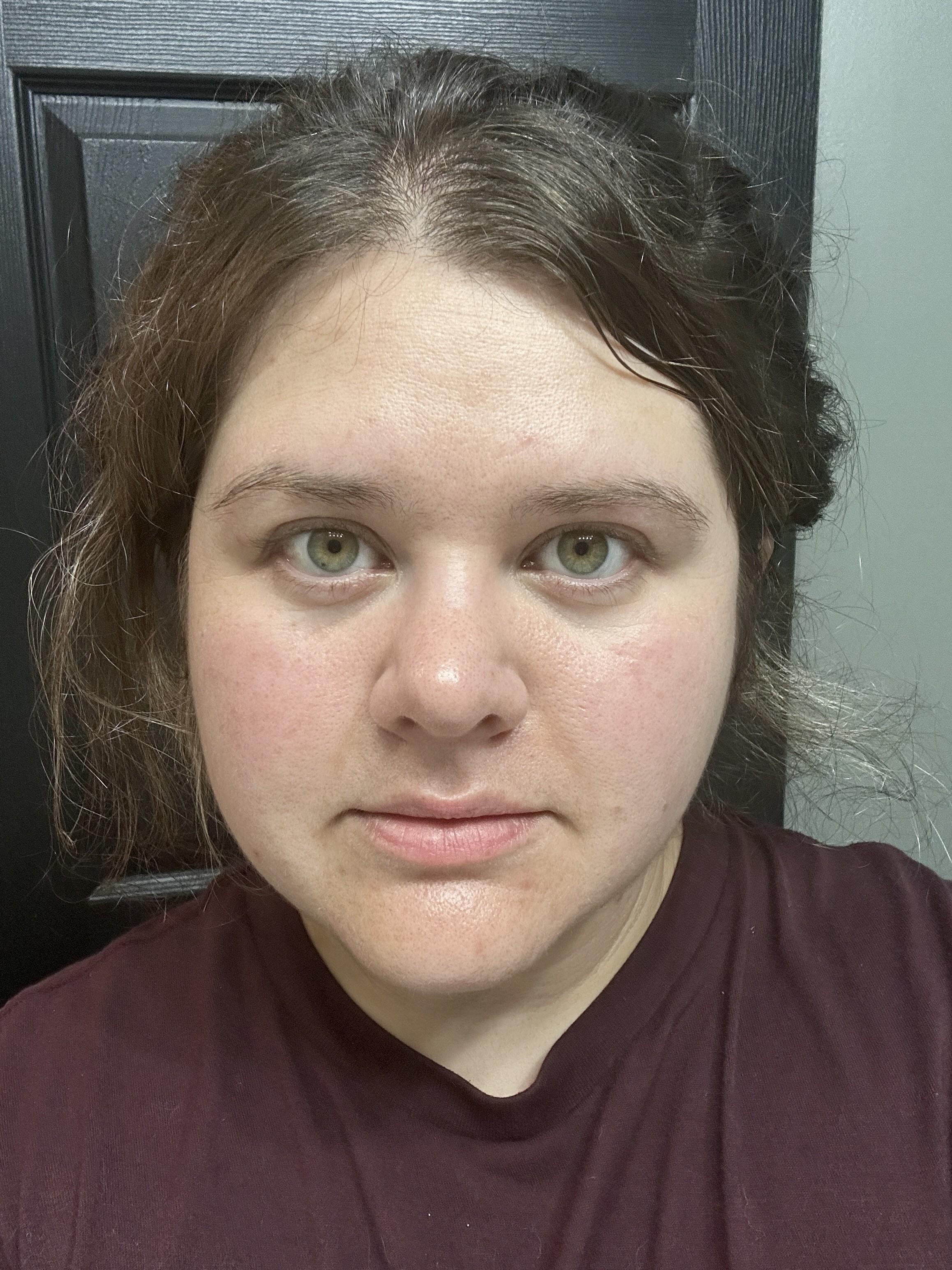 Photo from review by Ash