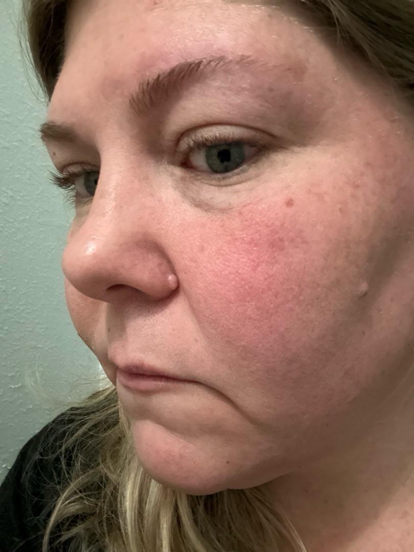 Photo from review by breezyr