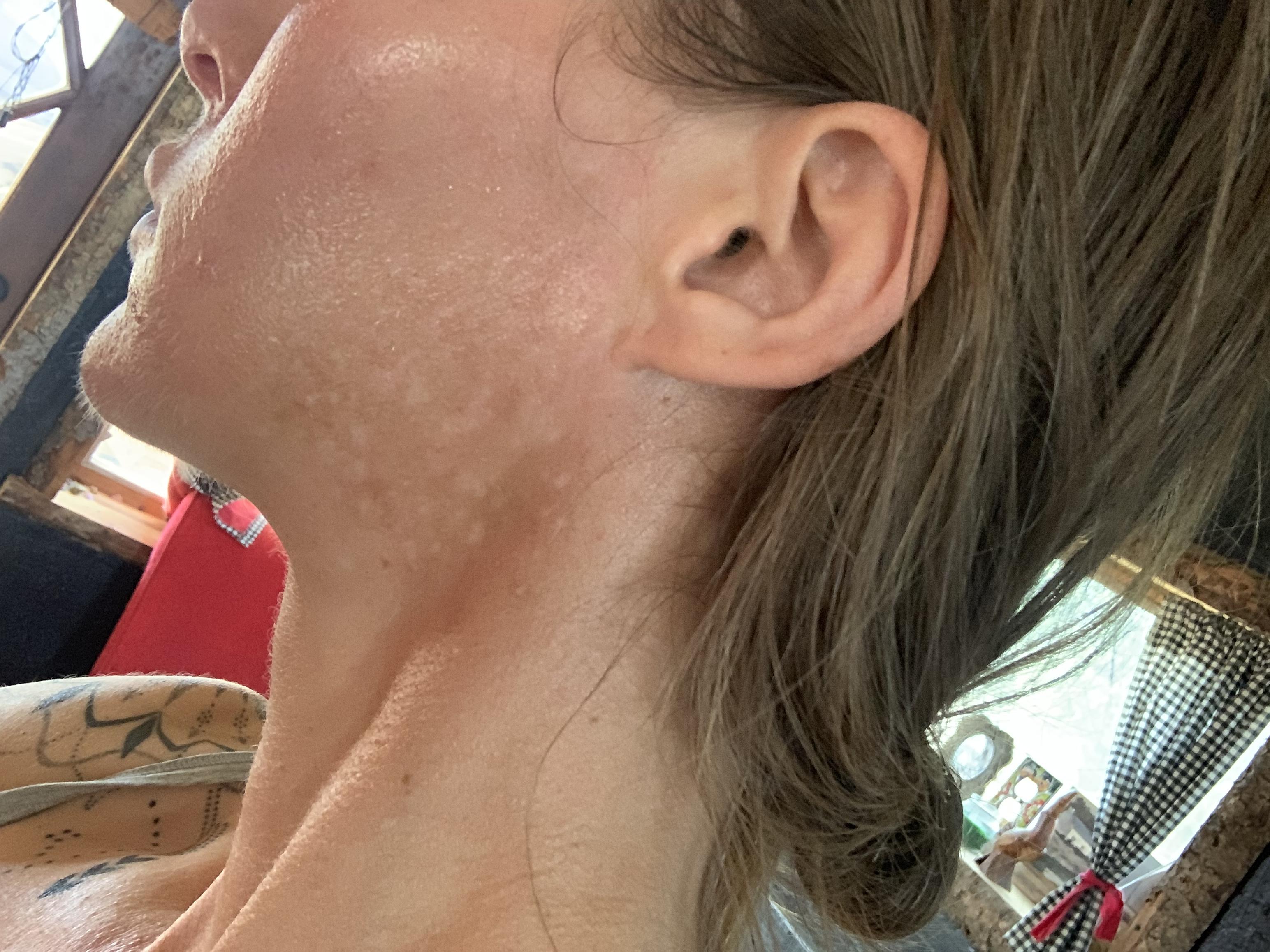 Photo from review by B