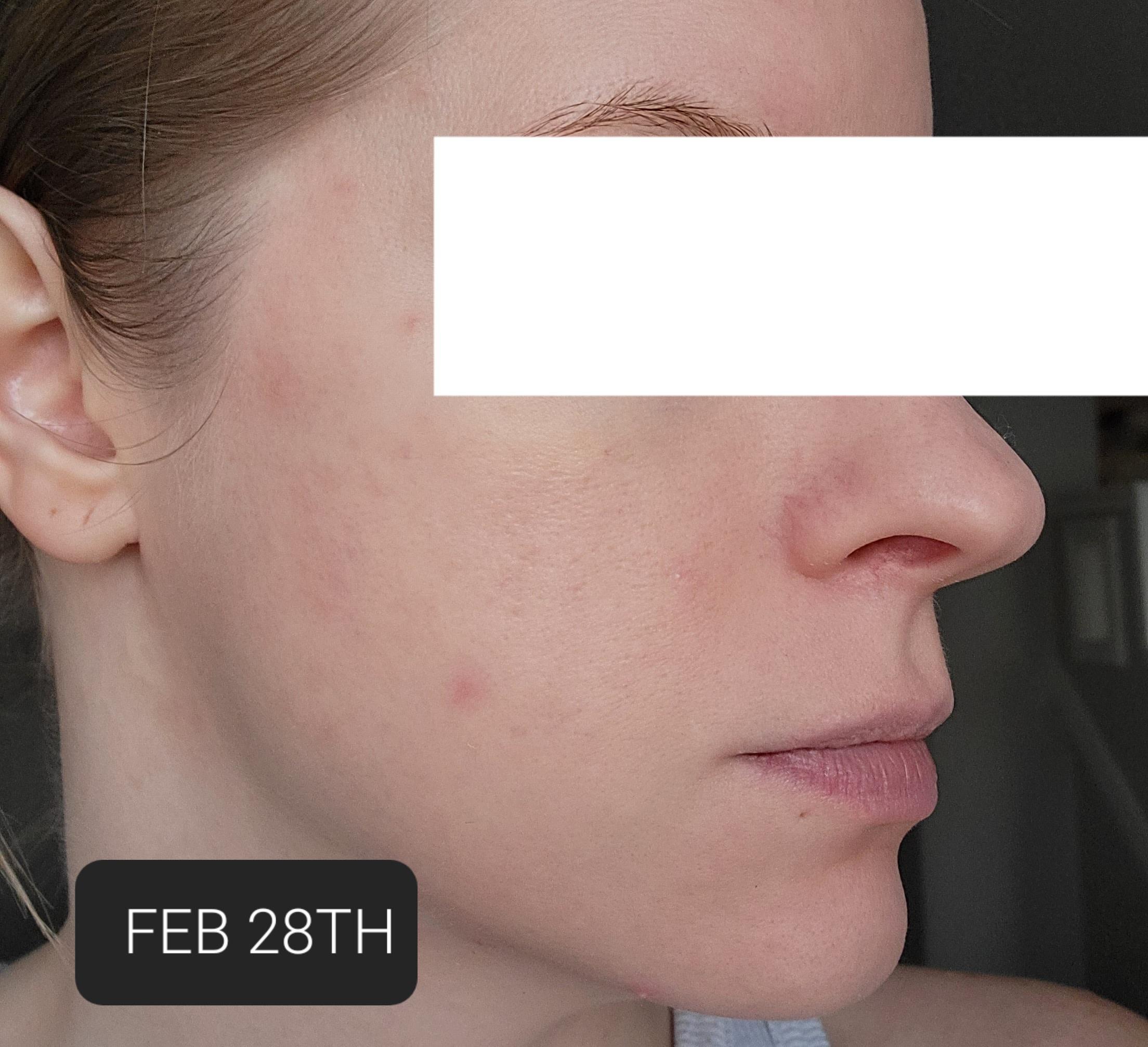 Photo from review by Joannah
