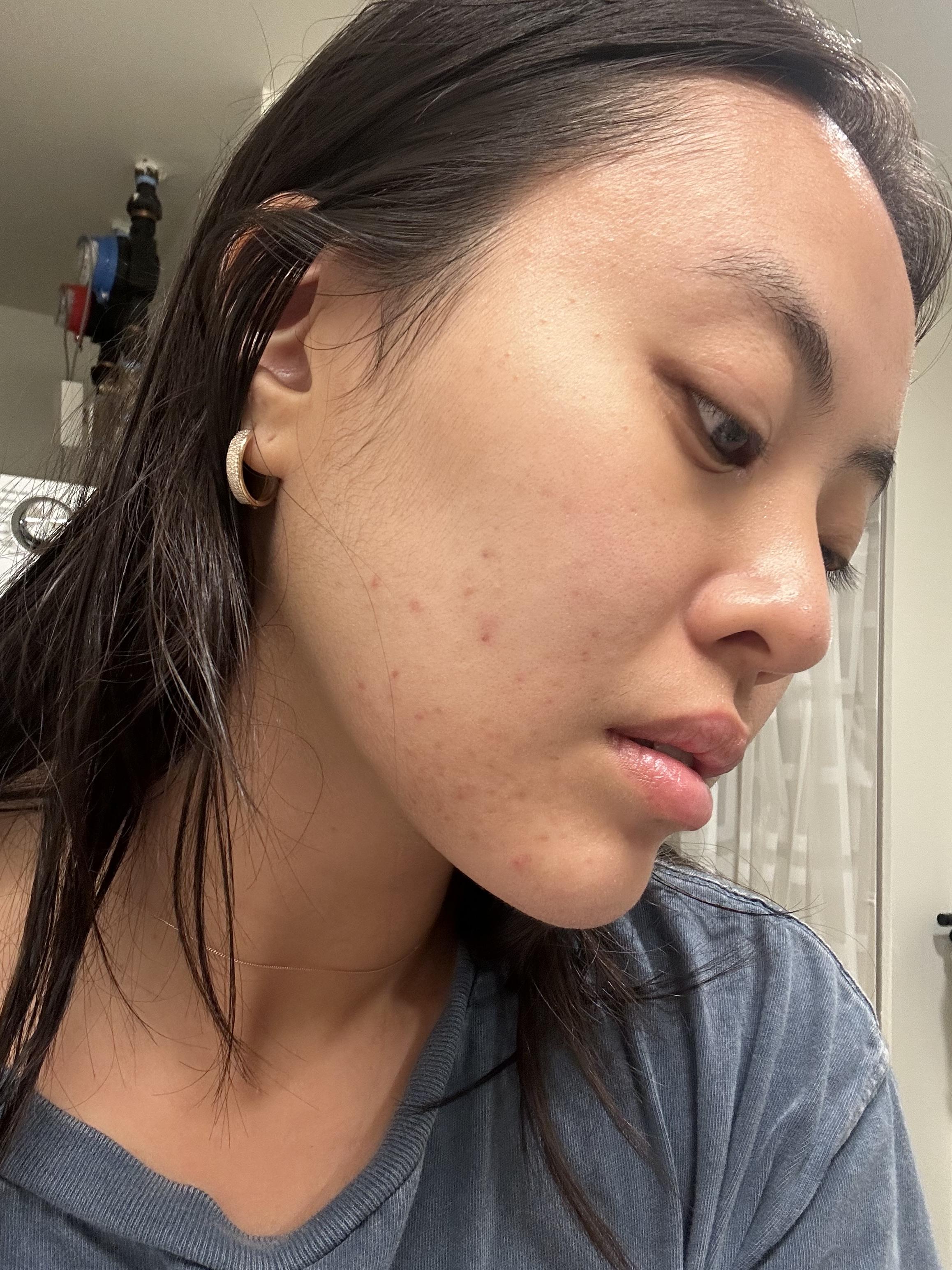 Photo from review by peachesofsummer