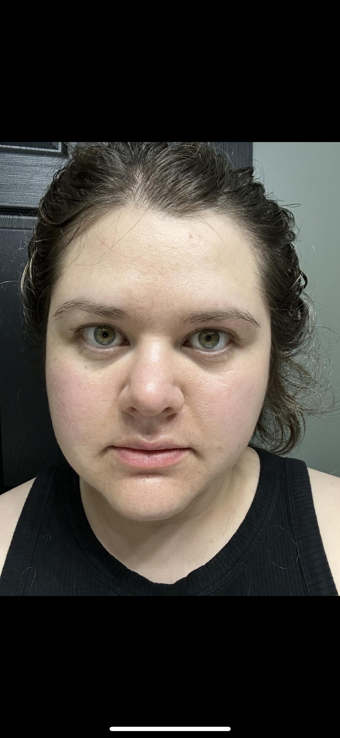 Photo from review by Ash