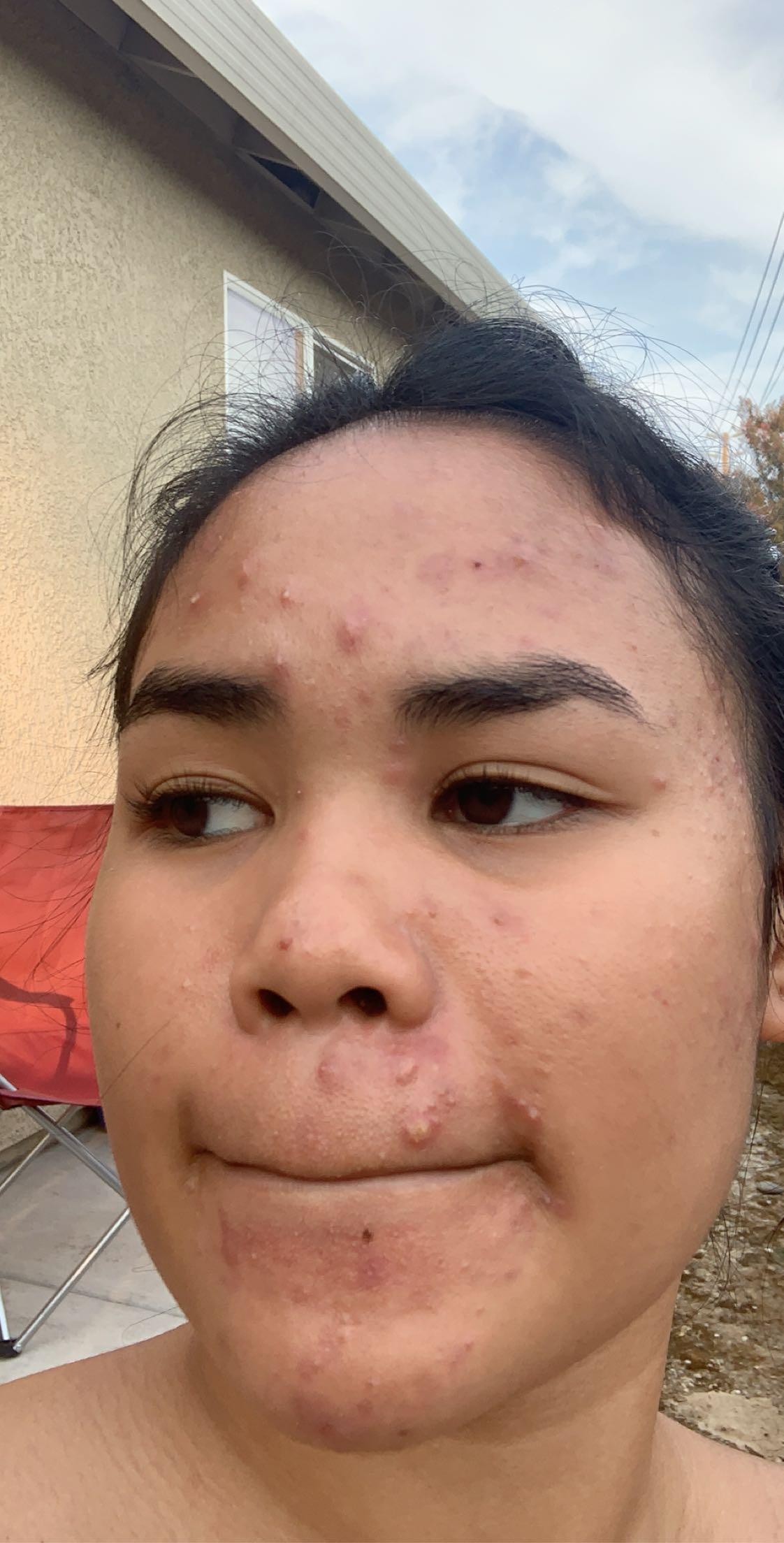 Photo from review by ajbrazy