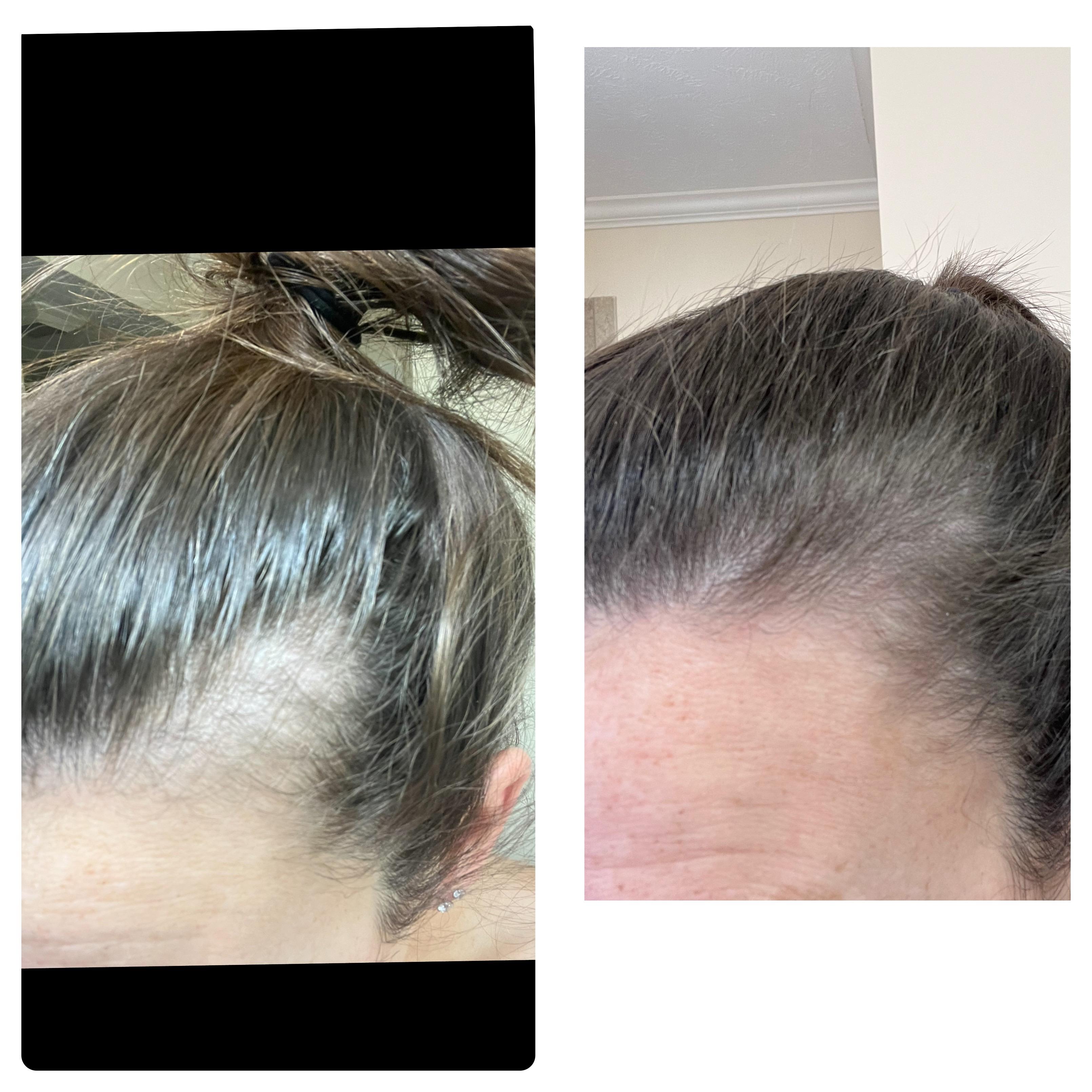 Photo from review by Girlmom