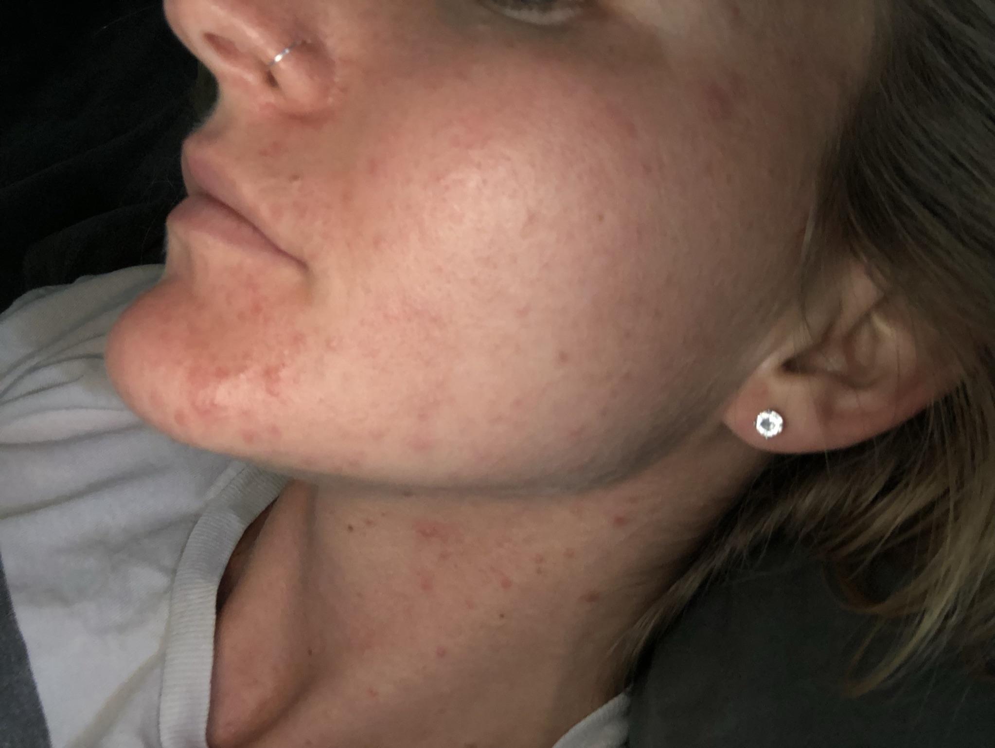 Photo from review by MChase44