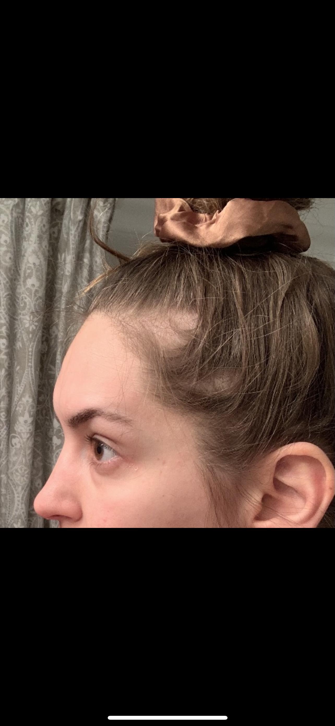 Photo from review by Tessaona